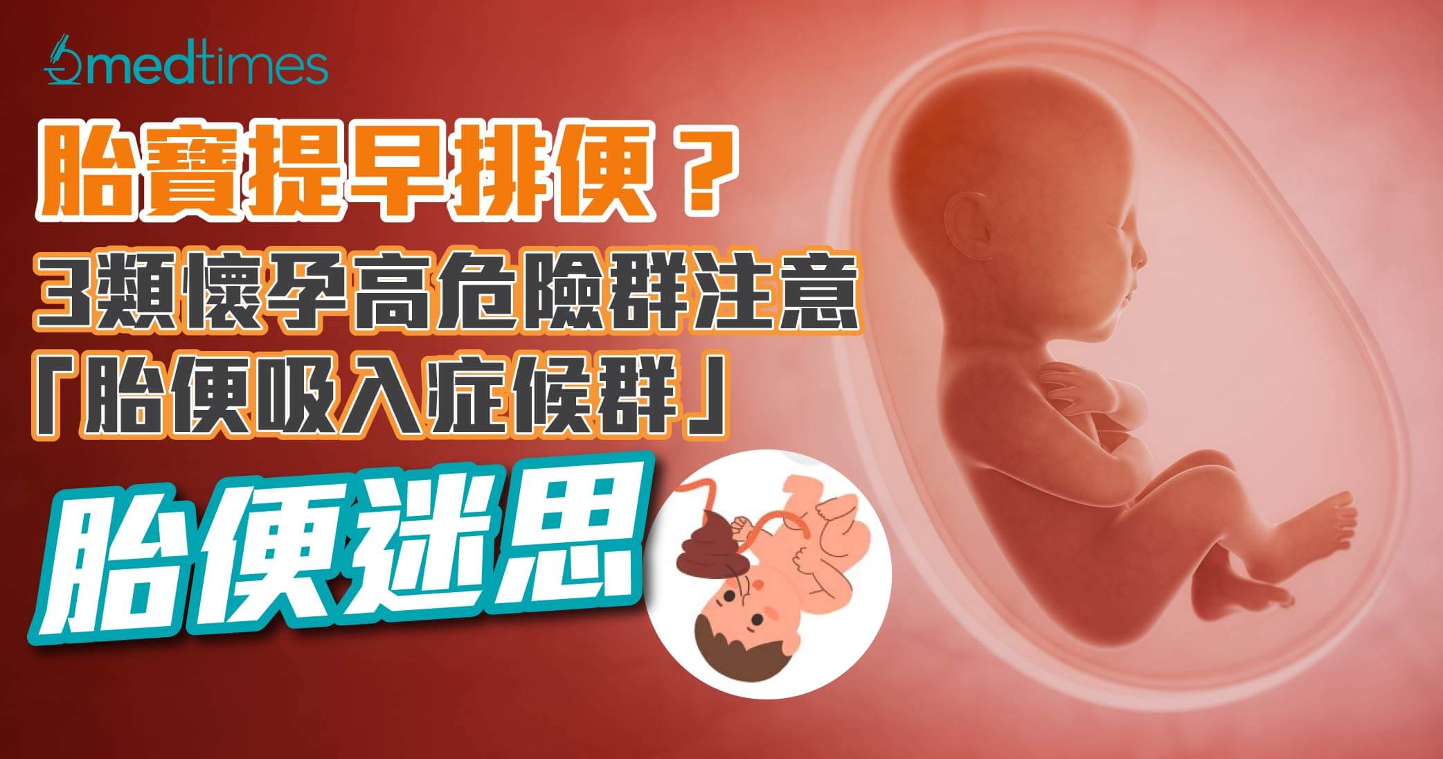 【胎便迷思】胎寶提早排便？3類懷孕高危險群注意「胎便吸入症候群」